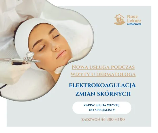 Nasz Lekarz elektrokoagulacja